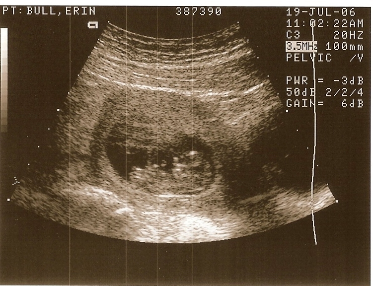 babybull3.jpg
